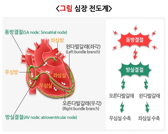 부정맥 병태생리 설명 이미지 1
