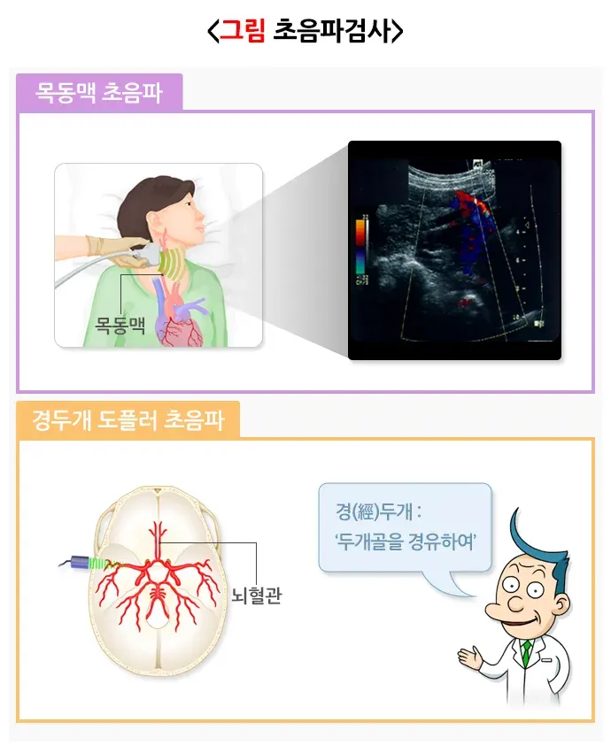일과성 허혈 발작 진단 및 검사 설명 이미지 4