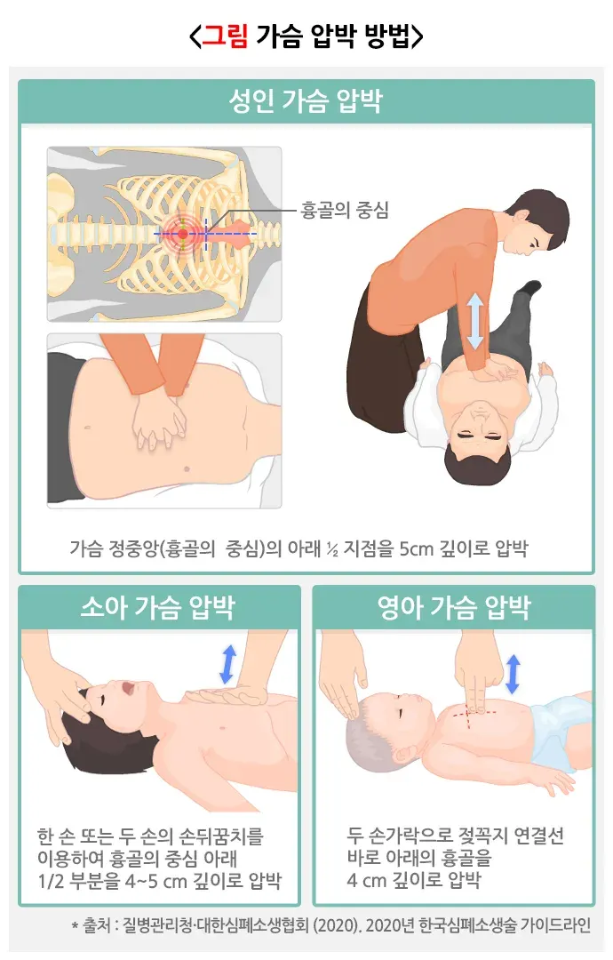 심폐소생술 치료 방법 설명 이미지 4
