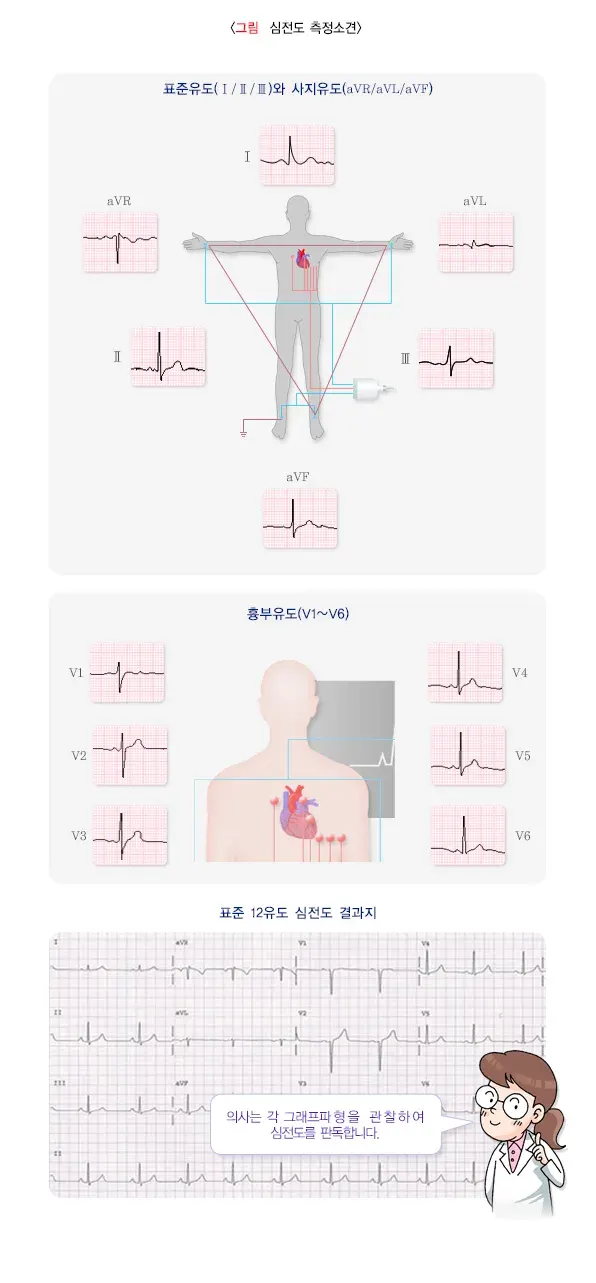 심전도검사 검사 장비 설명 이미지 1