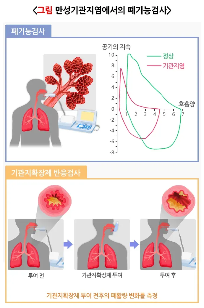 만성기관지염 진단 및 검사 설명 이미지 1