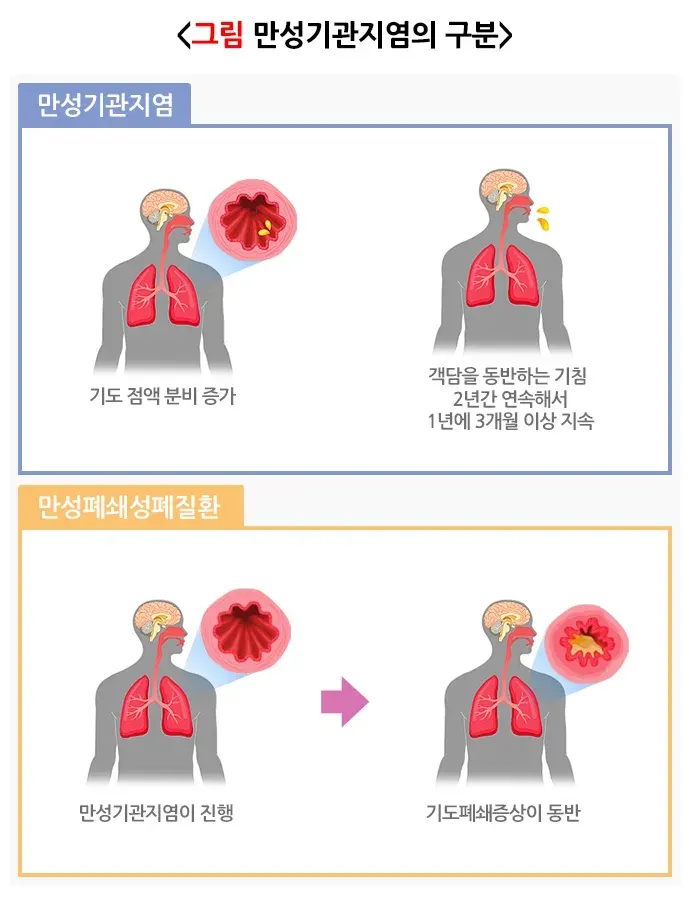만성기관지염 종류 설명 이미지 1