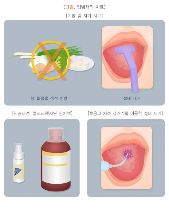 입냄새 치료 설명 이미지 1