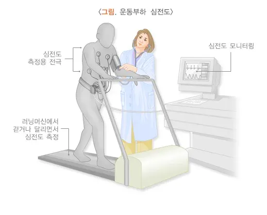 심전도검사 검사 장비 설명 이미지 2