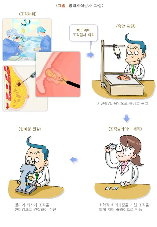 병리조직검사 검사 절차 설명 이미지 1