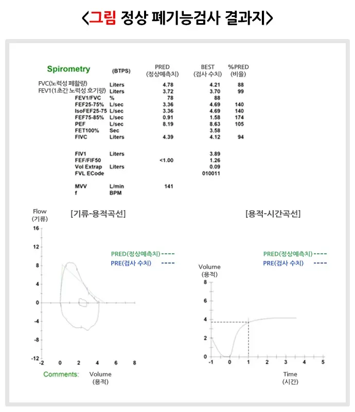 폐기능검사 검사 결과 해석 설명 이미지 1