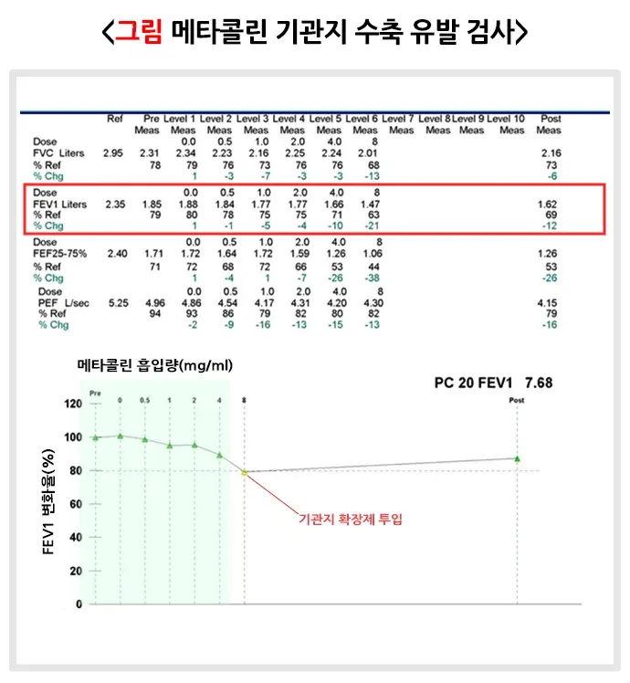 폐기능검사 검사 결과 해석 설명 이미지 6