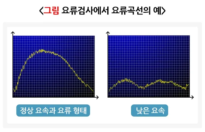 배뇨 관련 증상 또는 이상 진단 및 검사 설명 이미지 5