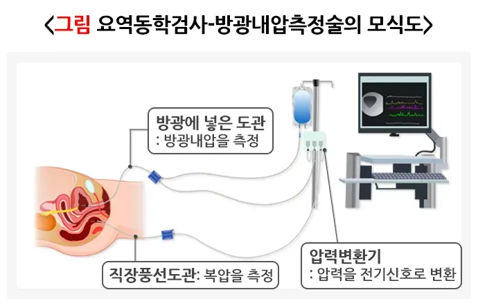 배뇨 관련 증상 또는 이상 진단 및 검사 설명 이미지 6