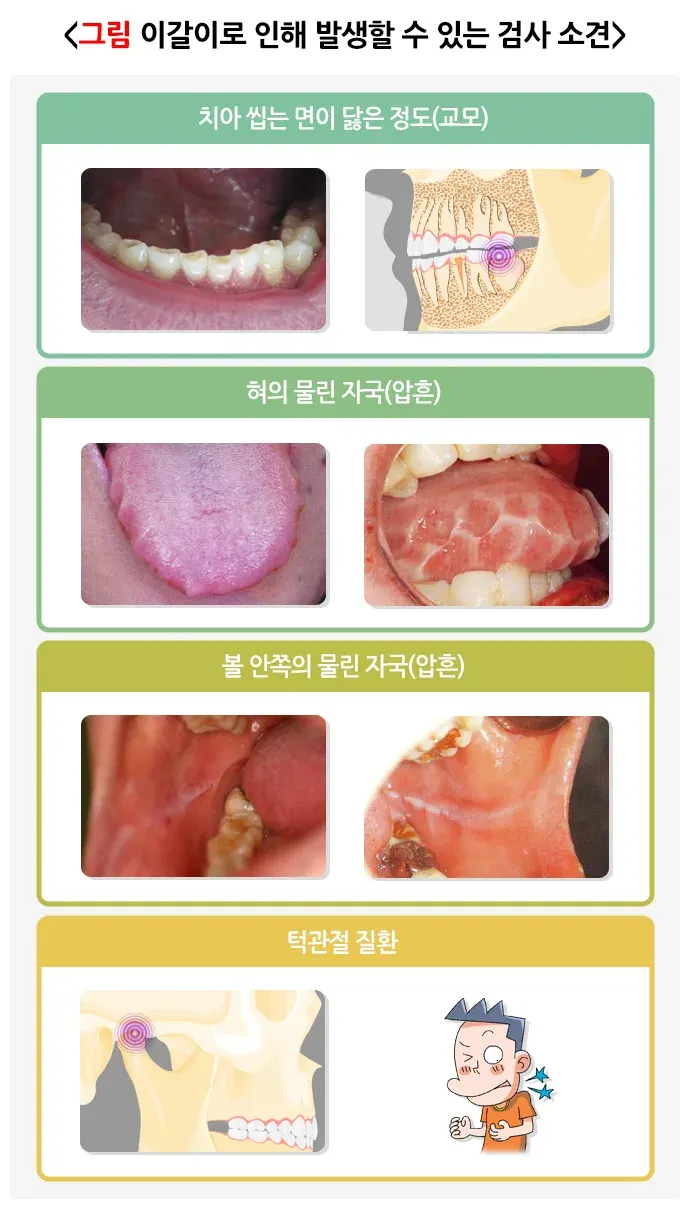 이갈이 진단 및 검사 설명 이미지 1