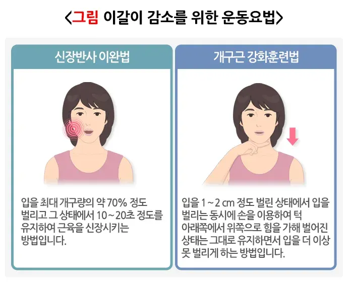 이갈이 비약물 치료 설명 이미지 4