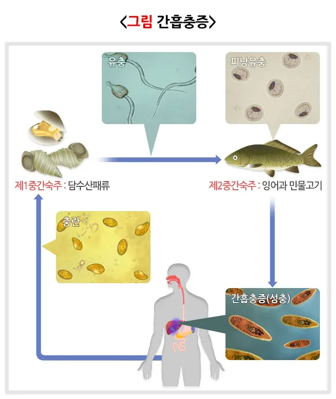 간흡충증 원인 및 감염경로 설명 이미지 1