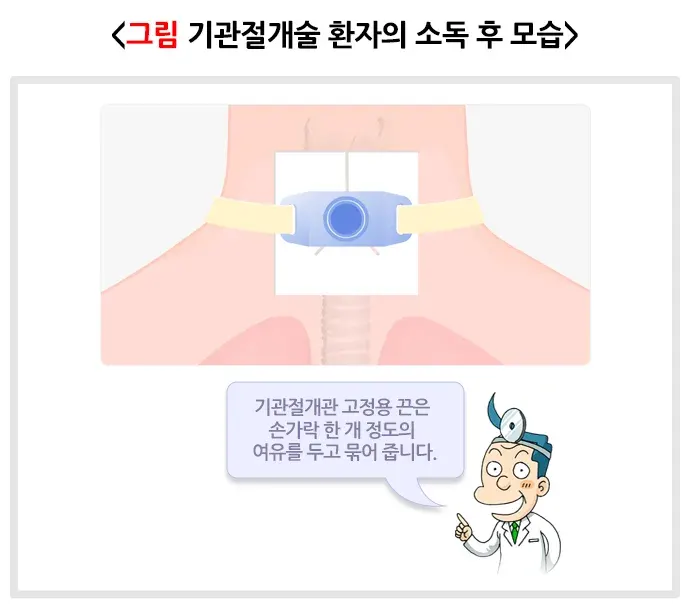 기관절개술 치료 후 관리 설명 이미지 1