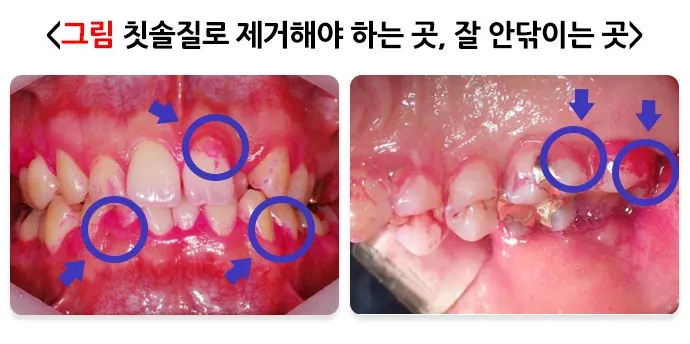 구강병 예방 및 관리방법! 알려드리겠습니다! 일반적 실천 방법 설명 이미지 1