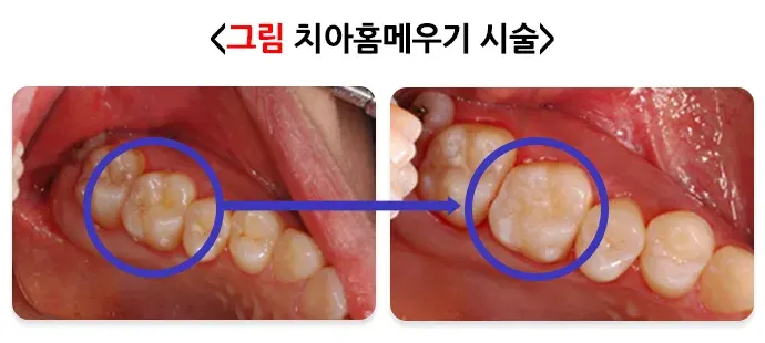 구강병 예방 및 관리방법! 알려드리겠습니다! 맞춤형 실천 방법 설명 이미지 1