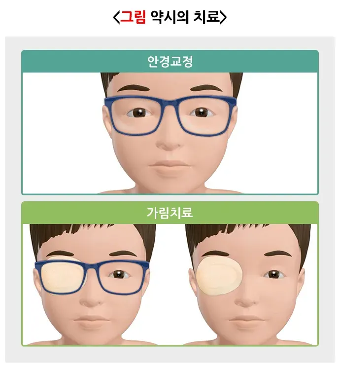 약시(소아) 치료 설명 이미지 1