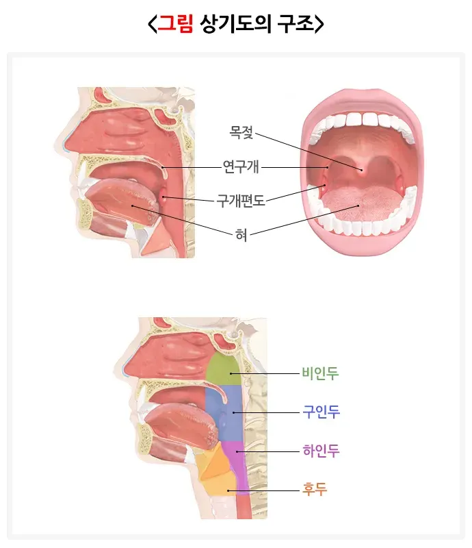 수면무호흡증 원인 설명 이미지 1