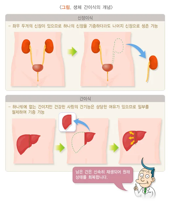 간이식수술 치료 관련 검사 설명 이미지 1
