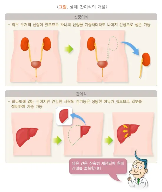 간이식수술 치료 관련 검사 설명 이미지 1