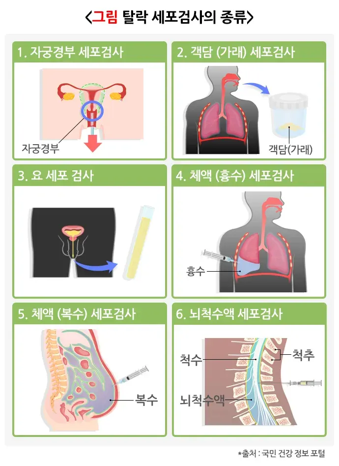 세포검사 검사 항목 설명 이미지 3