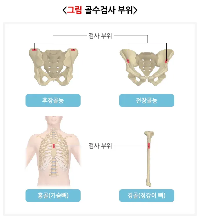 골수검사 검사 절차 설명 이미지 1