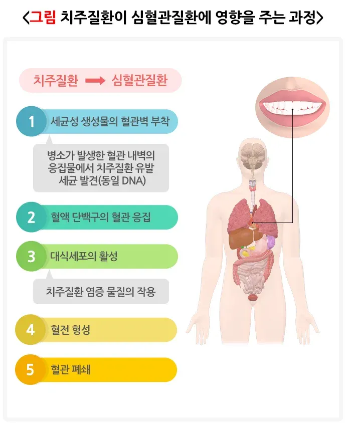 구강병 예방 및 관리방법! 알려드리겠습니다! 건강에 미치는 영향 설명 이미지 1