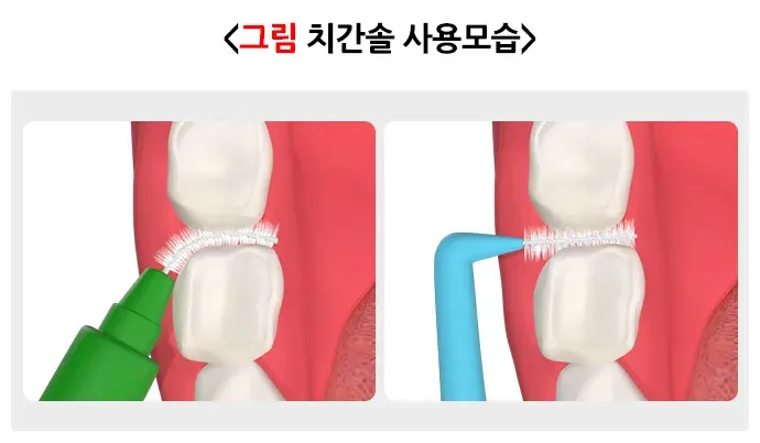 구강병 예방 및 관리방법! 알려드리겠습니다! 일반적 실천 방법 설명 이미지 3