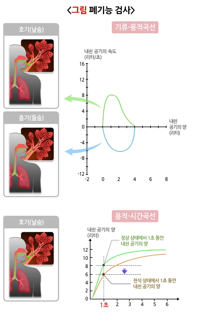폐기능검사 검사 항목 설명 이미지 1
