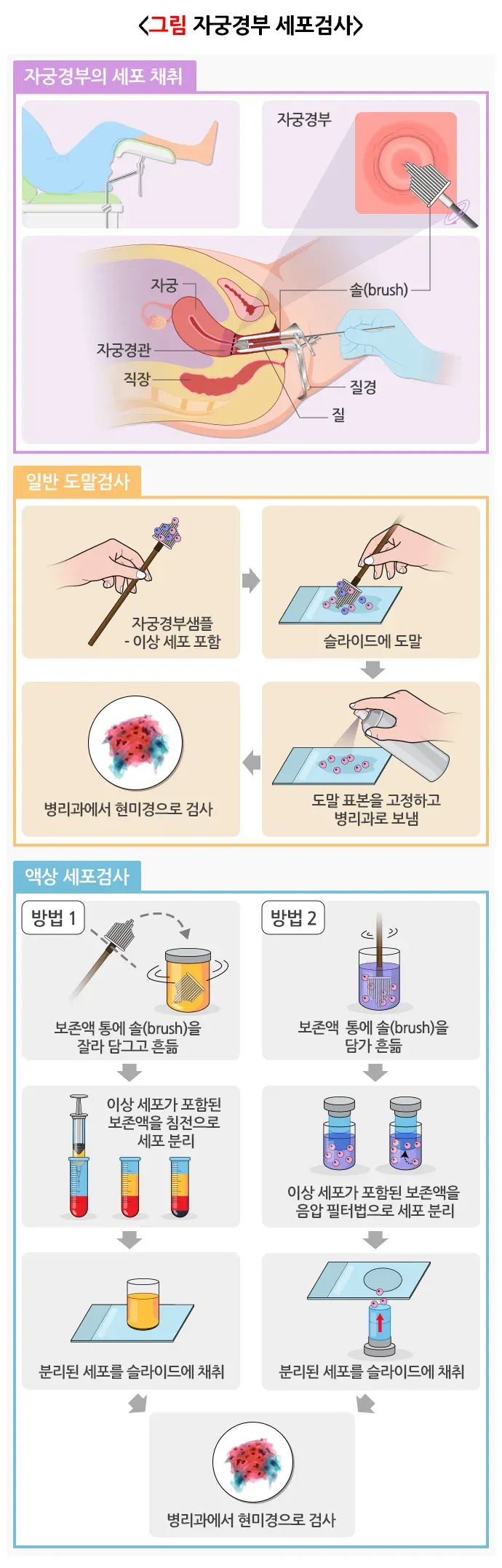 세포검사 검사 항목 설명 이미지 2