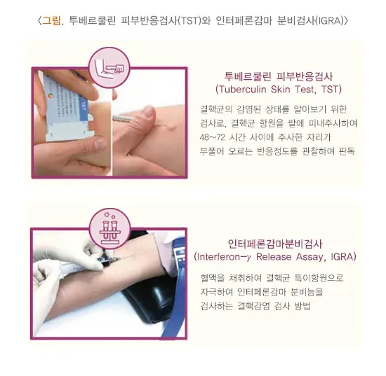 결핵 진단 및 검사 설명 이미지 1