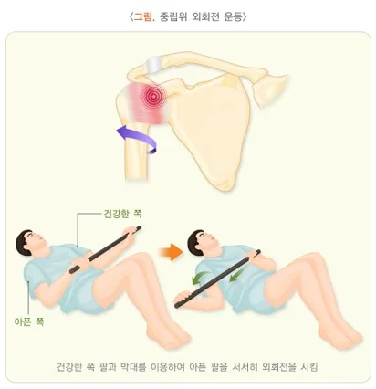 오십견 비약물 치료 설명 이미지 2