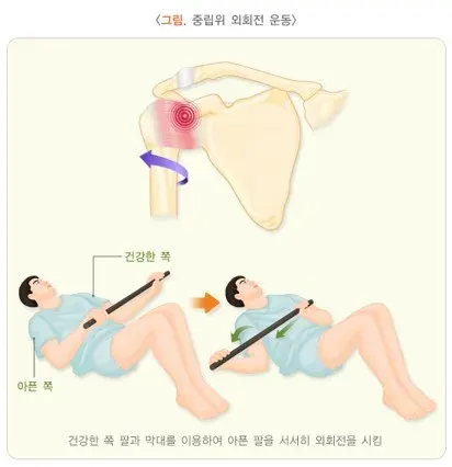 오십견 비약물 치료 설명 이미지 2
