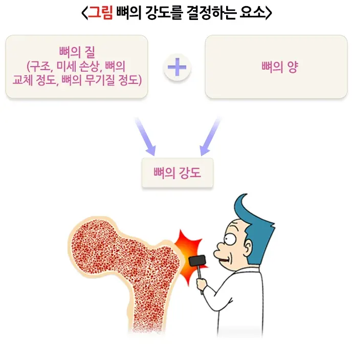 골다공증 정의 설명 이미지 1