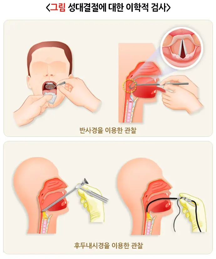 성대결절 진단 및 검사 설명 이미지 1