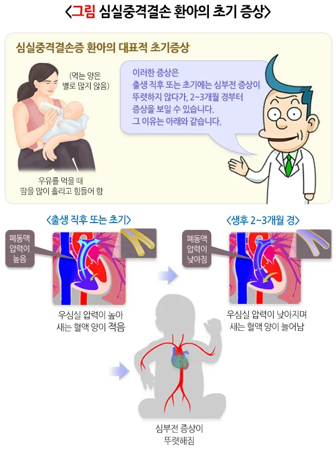 심실중격결손증 증상 설명 이미지 2