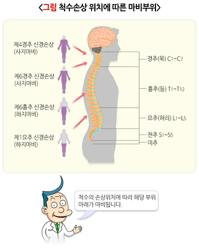 외상성 척수손상 종류 설명 이미지 1