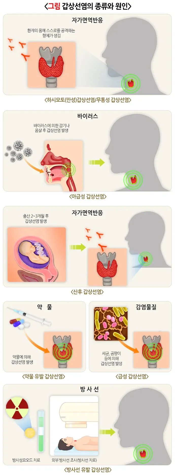 갑상선염 원인 설명 이미지 1