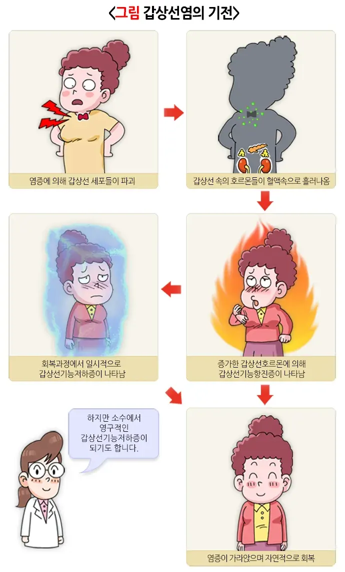 갑상선염 병태생리 설명 이미지 1