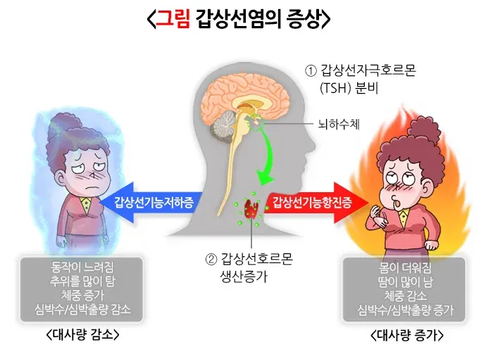 갑상선염 증상 설명 이미지 1