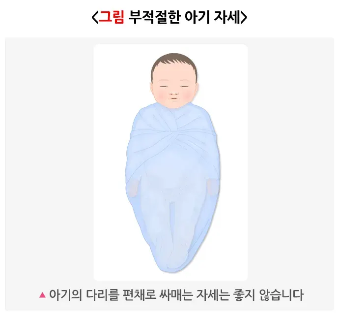 발달성 고관절 이형성증 및 탈구 생활습관 관리 설명 이미지 1