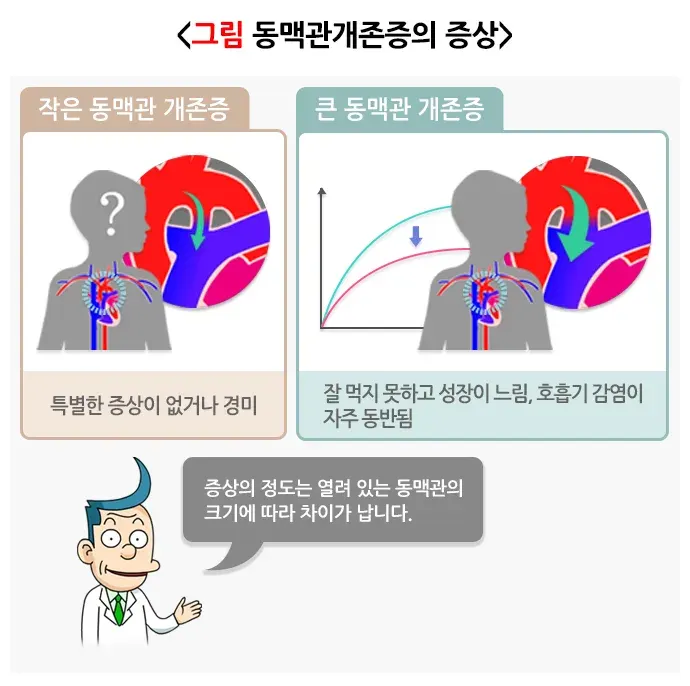 동맥관 개존증 증상 설명 이미지 1