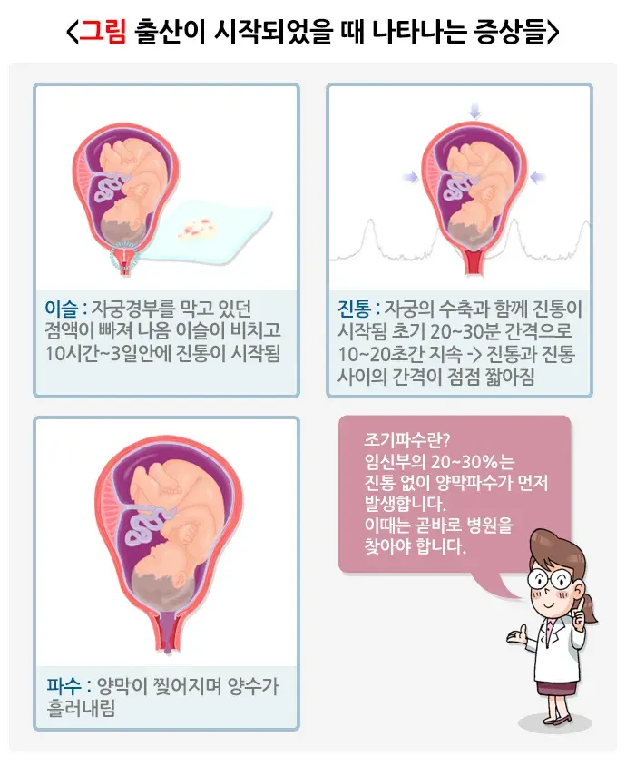 자연분만과정 경과 및 예후 설명 이미지 2