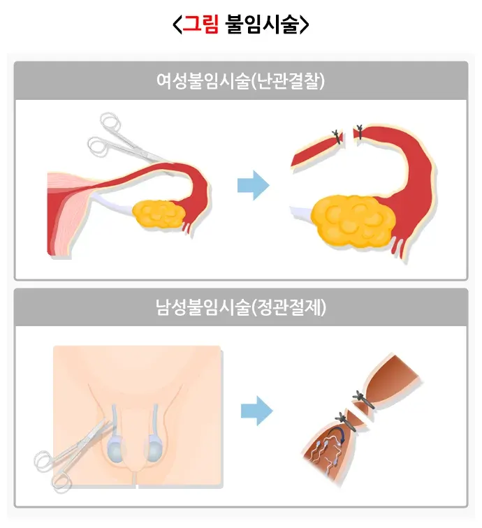 피임 치료 설명 이미지 6