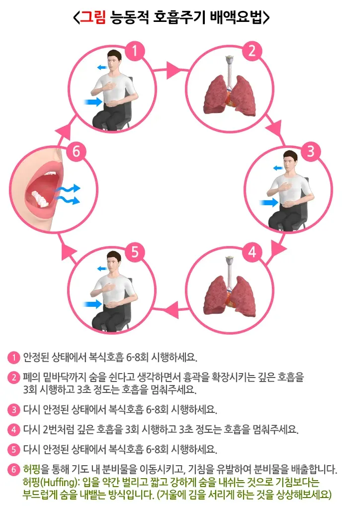 기관지확장증 비약물 치료 설명 이미지 1