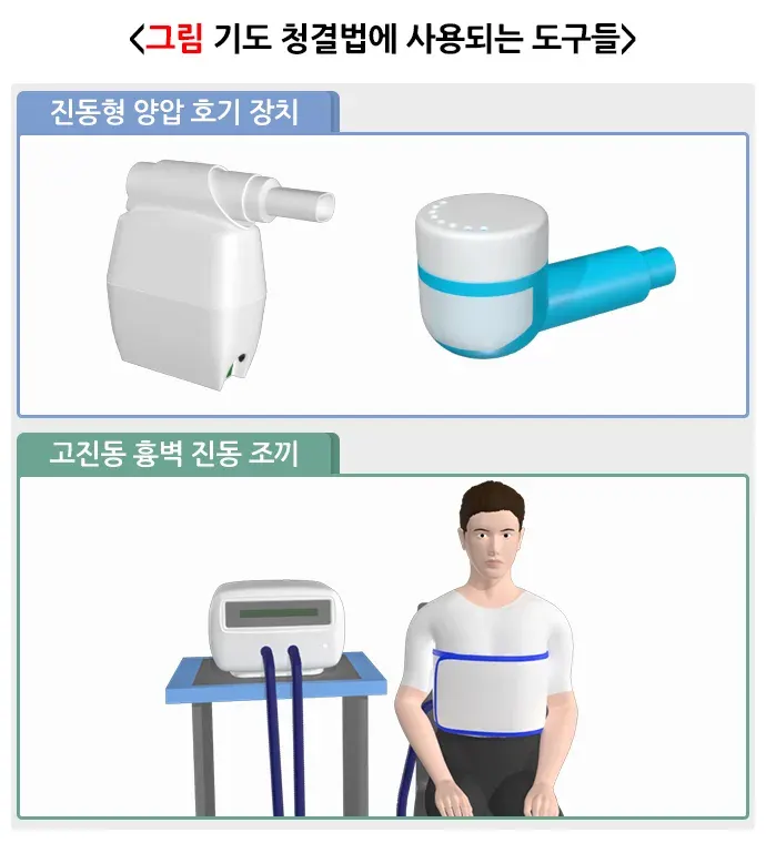 기관지확장증 비약물 치료 설명 이미지 3