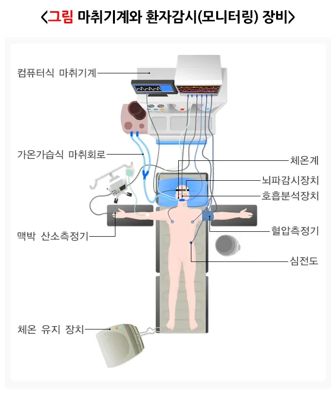 전신마취 치료의 적응증 설명 이미지 2