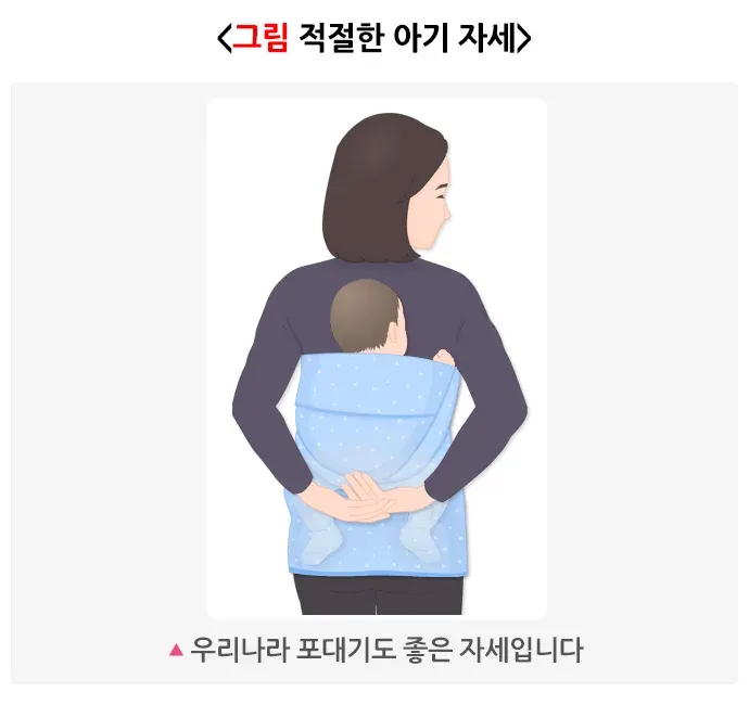 발달성 고관절 이형성증 및 탈구 생활습관 관리 설명 이미지 2