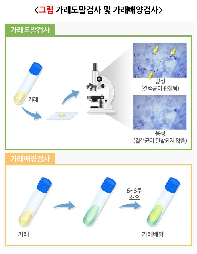 결핵 진단 및 검사 설명 이미지 3