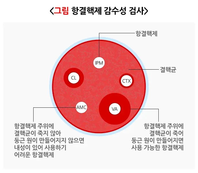 결핵 진단 및 검사 설명 이미지 4