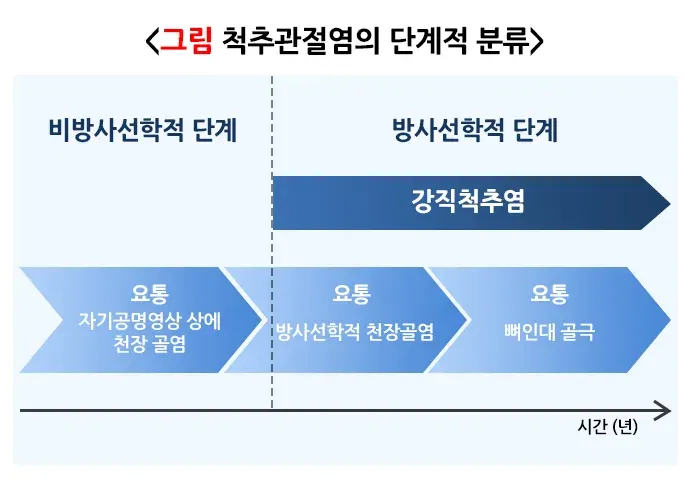강직척추염 정의 설명 이미지 1
